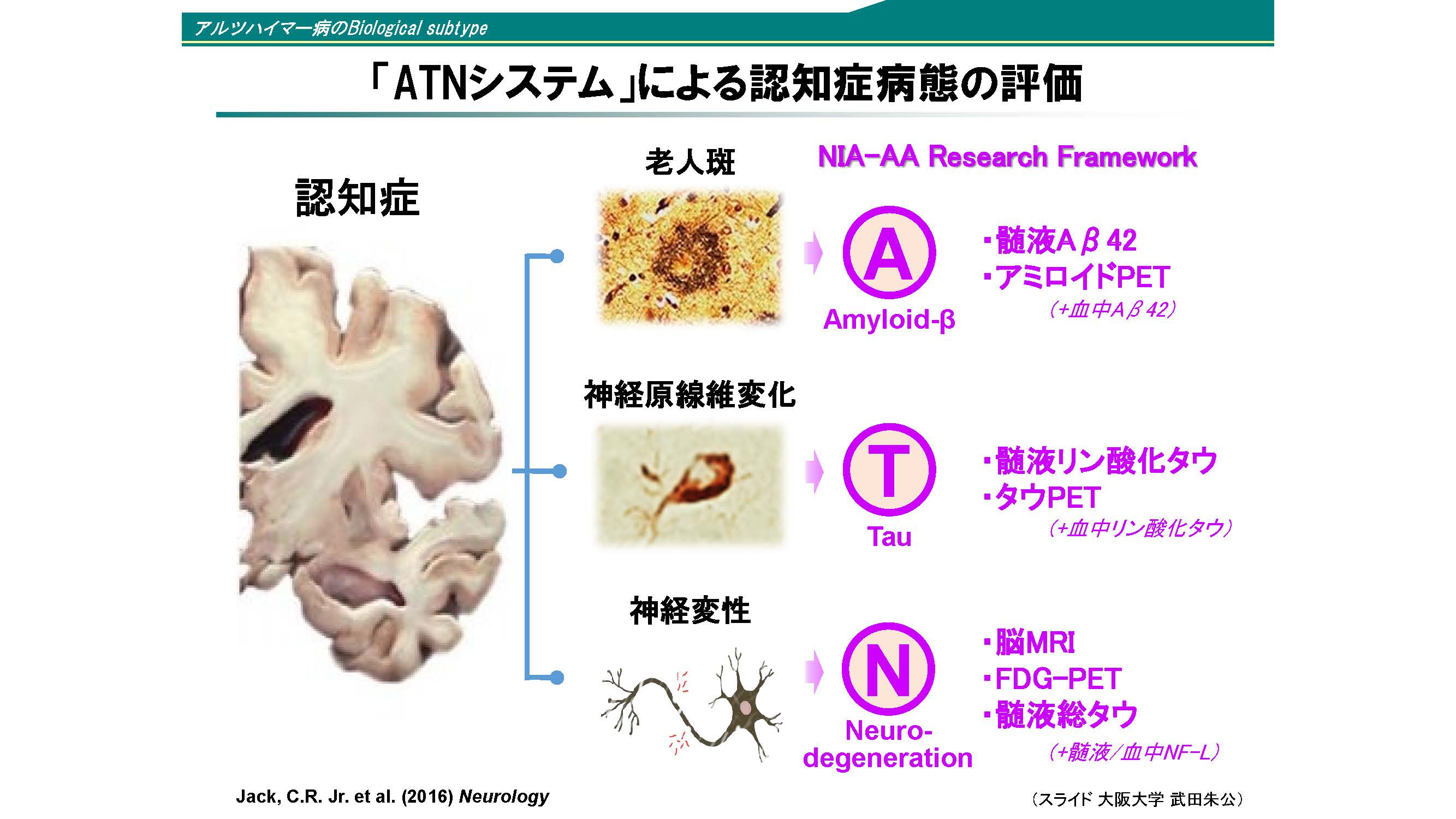 �uATN�V�X�e���v�ɂ��F�m�Ǖa�Ԃ̕]��